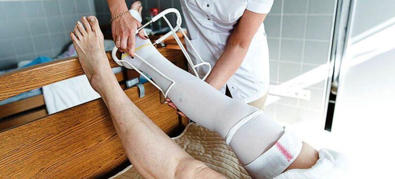 kompresný pančuchový tovar na liečbu kŕčových žíl